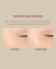 EXOPOLISACARIDOS
